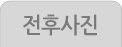 전후사진