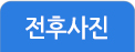 전후사진